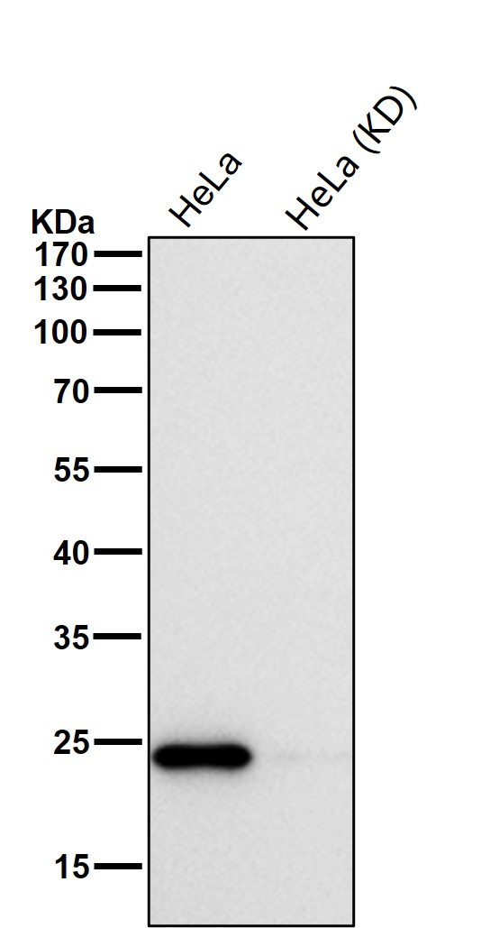 Rabbit Monoclonal to KRAS+HRAS+NRAS