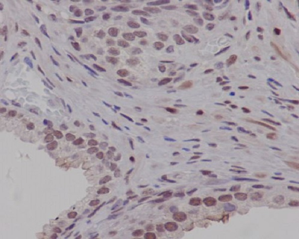 Rabbit Monoclonal to PIM1