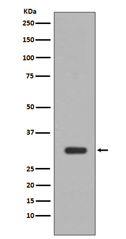 Rabbit Monoclonal to PIM1