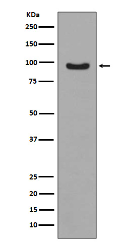 Rabbit Monoclonal to Phospho-FOXO3a(S253)