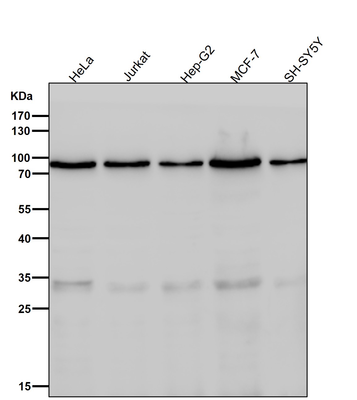 Rabbit Monoclonal to Phospho-FOXO3a(S253)