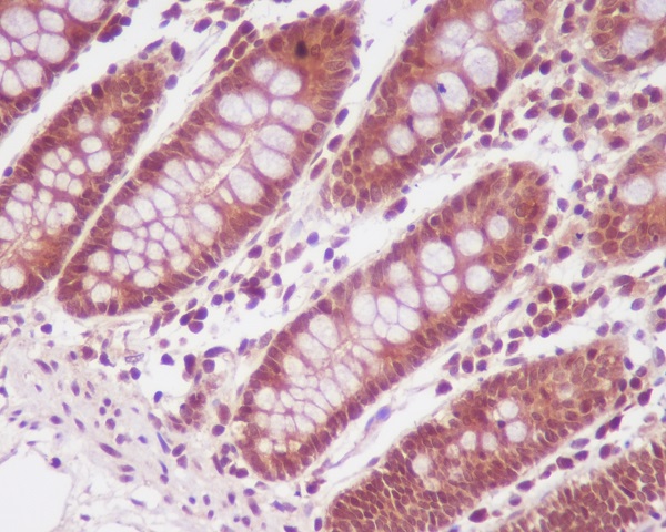 Rabbit Monoclonal to PP2A alpha+beta