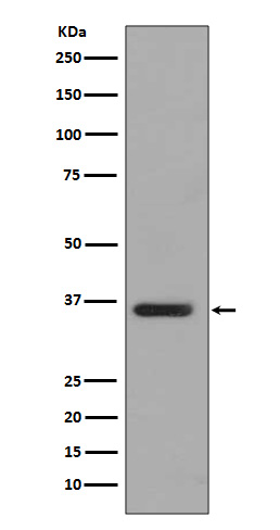 Rabbit Monoclonal to PP2A alpha+beta