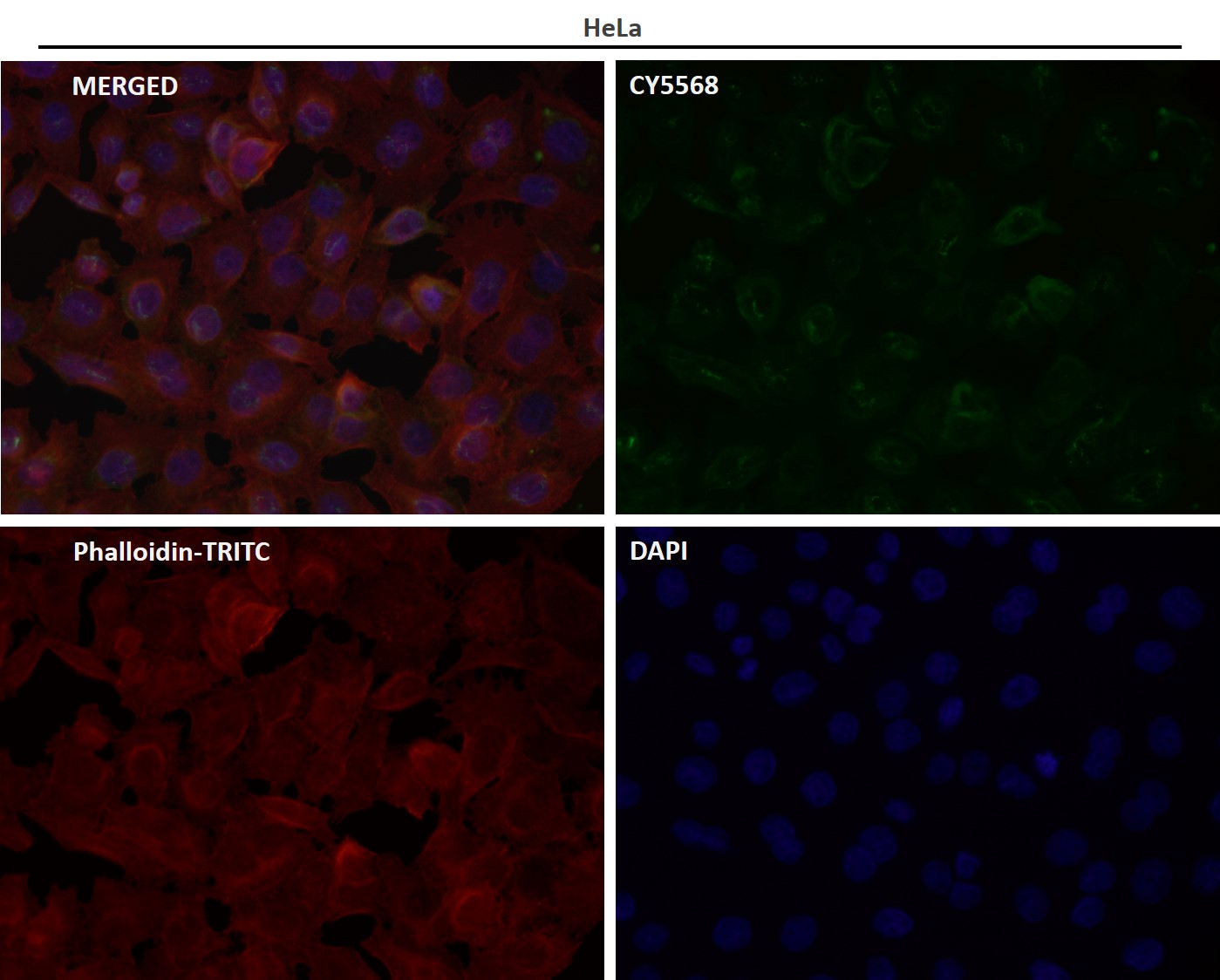 Rabbit Monoclonal to Cytokeratin 16