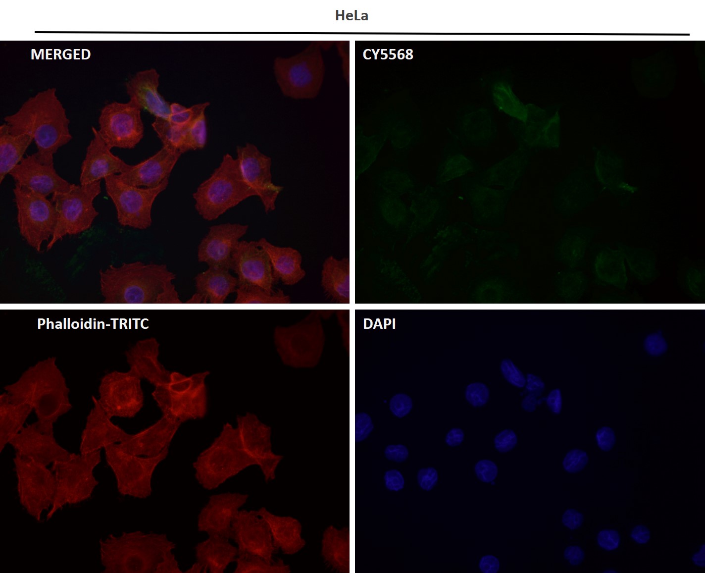 Rabbit Monoclonal to Cytokeratin 16