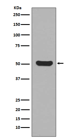 Rabbit Monoclonal to Cytokeratin 16