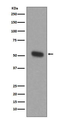 Rabbit Monoclonal to TPH1