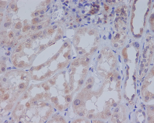Rabbit Monoclonal to ACC1
