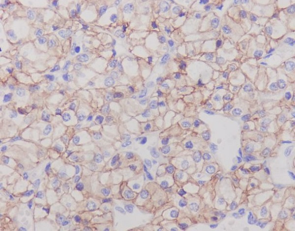 Rabbit Monoclonal to Carbonic Anhydrase IX