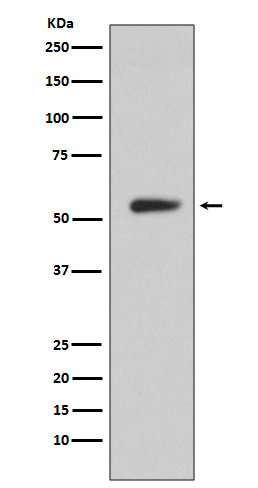 Carbonic Anhydrase IX