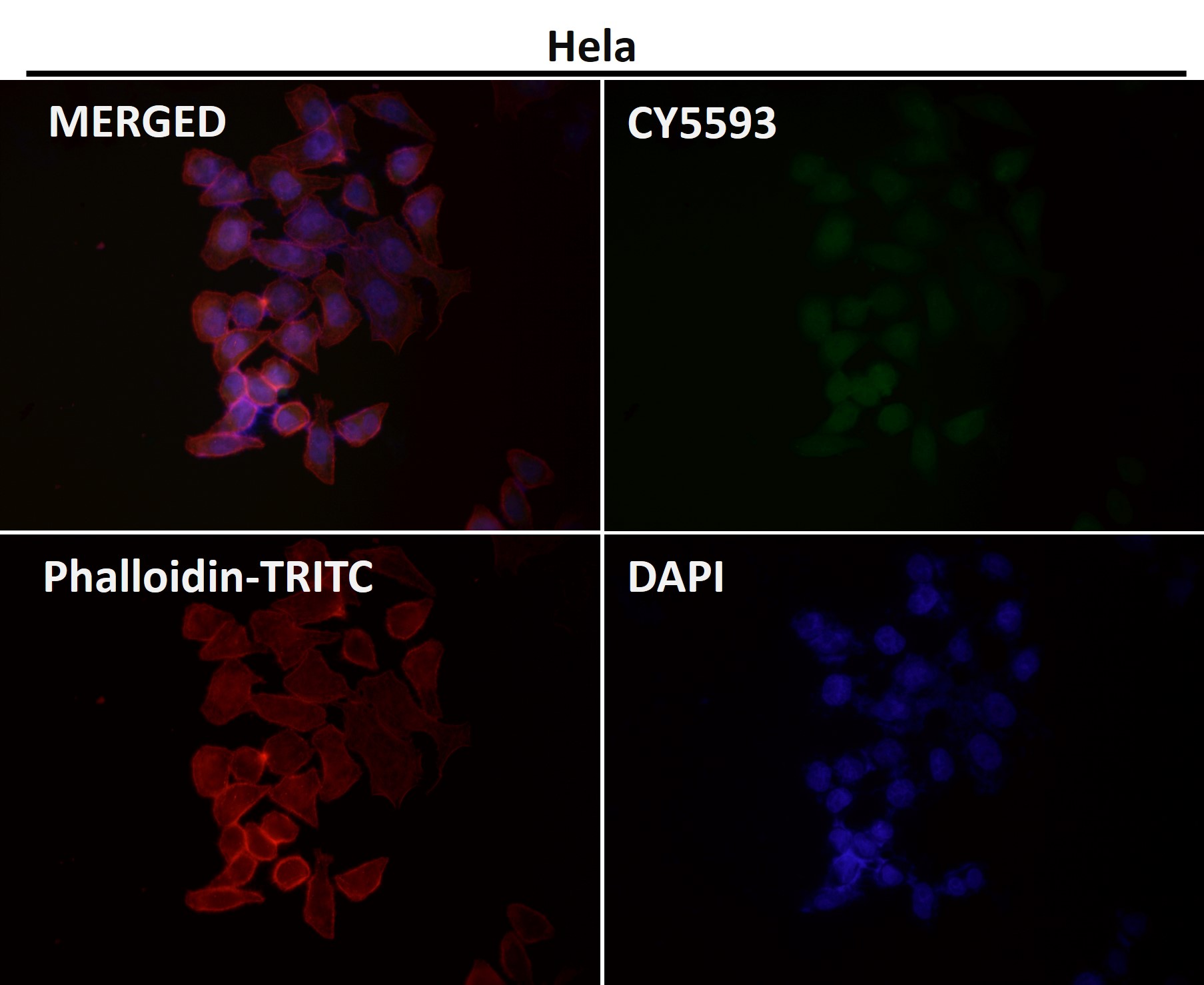 Rabbit Monoclonal to Smad2