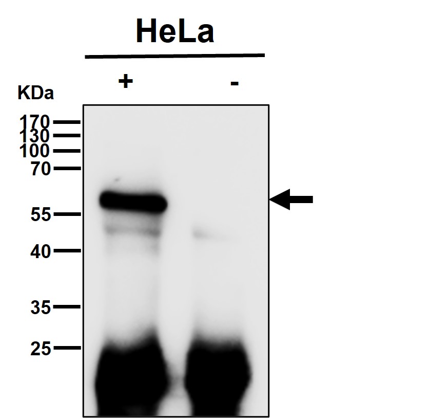 Rabbit Monoclonal to Smad2