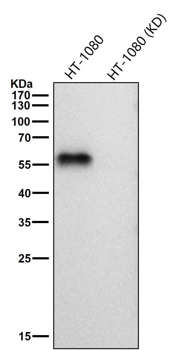 Rabbit Monoclonal to Smad2