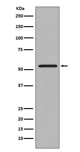 Rabbit Monoclonal to Smad2