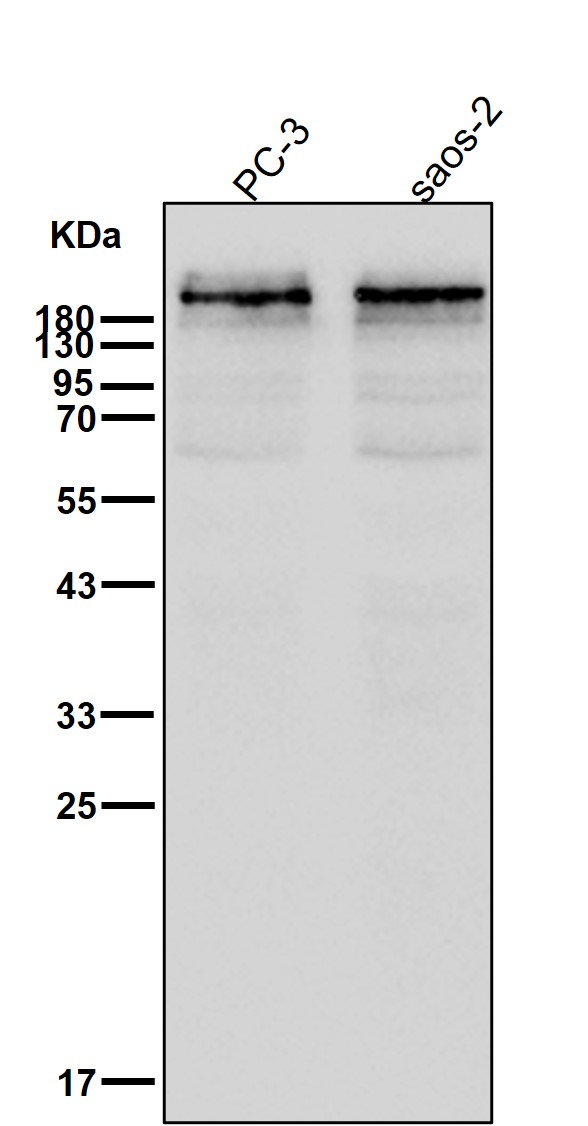 Rabbit Monoclonal to Dysferlin(Romeo)