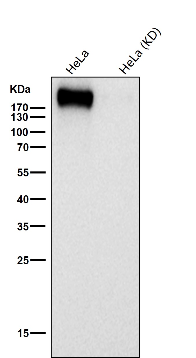Rabbit Monoclonal to Tuberin