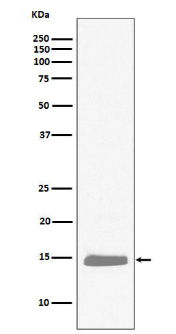 Hemoglobin subunit alpha