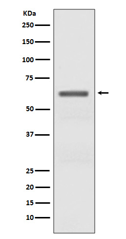 Rabbit Monoclonal to Phospho-AMPK alpha(Thr172)