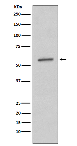 Rabbit Monoclonal to SGK1