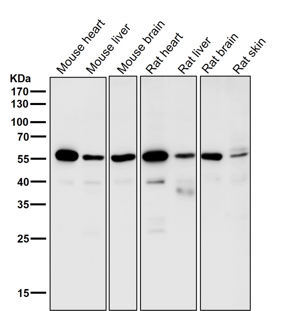 Rabbit Monoclonal to SGK1