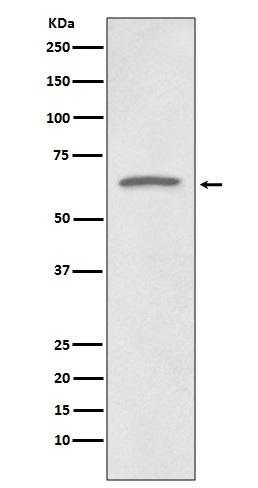Rabbit Monoclonal to p73