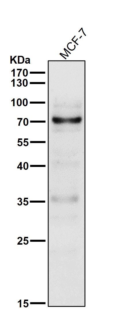 Rabbit Monoclonal to p73