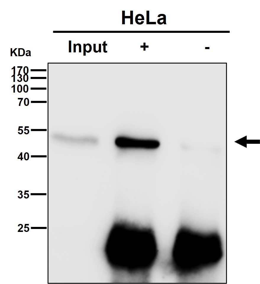 Rabbit Monoclonal to Estrogen Related Receptor alpha