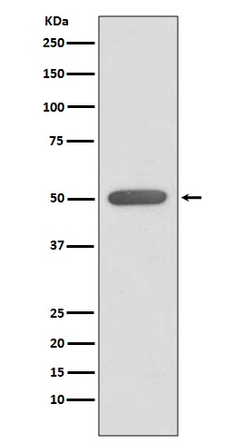 Rabbit Monoclonal to Estrogen Related Receptor alpha