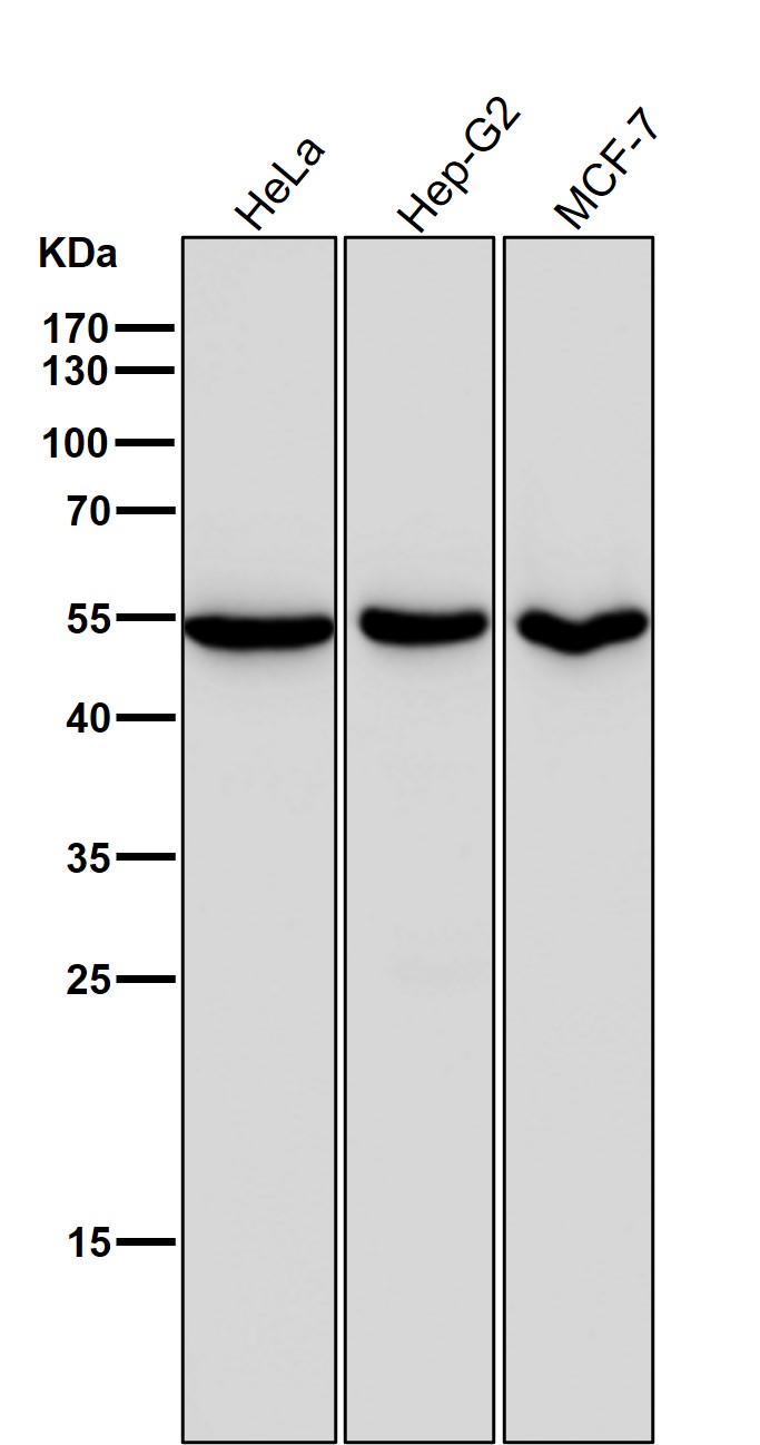 Rabbit Monoclonal to Estrogen Related Receptor alpha