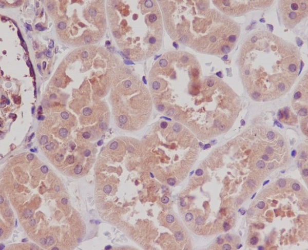 Rabbit Monoclonal to STK3