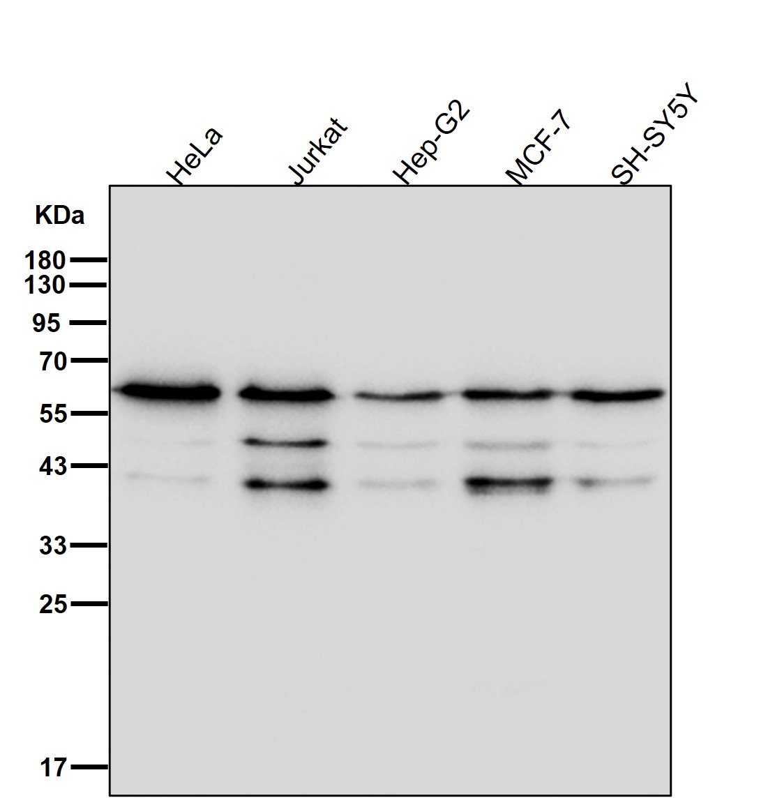 Rabbit Monoclonal to STK3