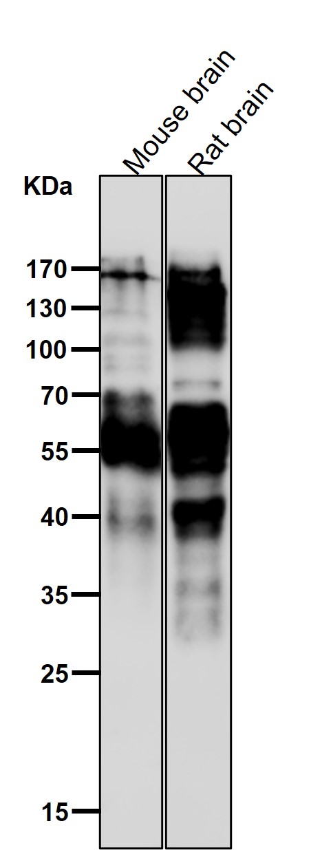 Phospho-Tau(T231)