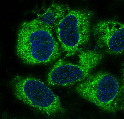Rabbit Monoclonal to PBP