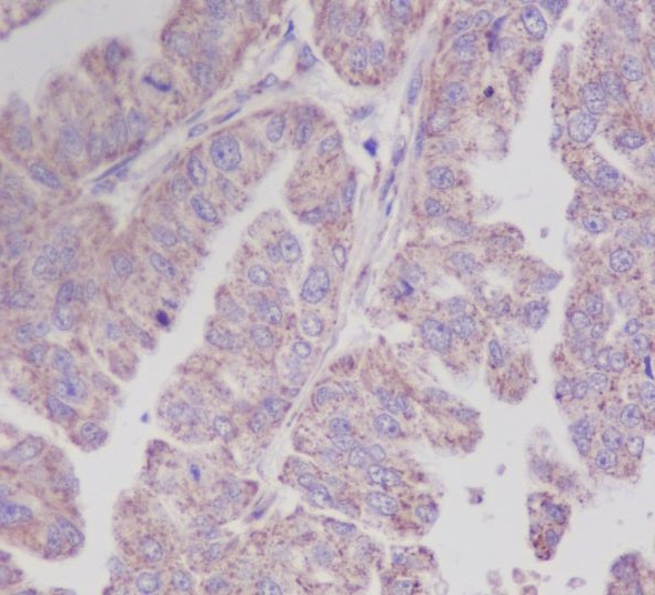 Rabbit Monoclonal to PBP