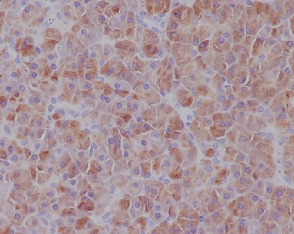 Rabbit Monoclonal to IRF7