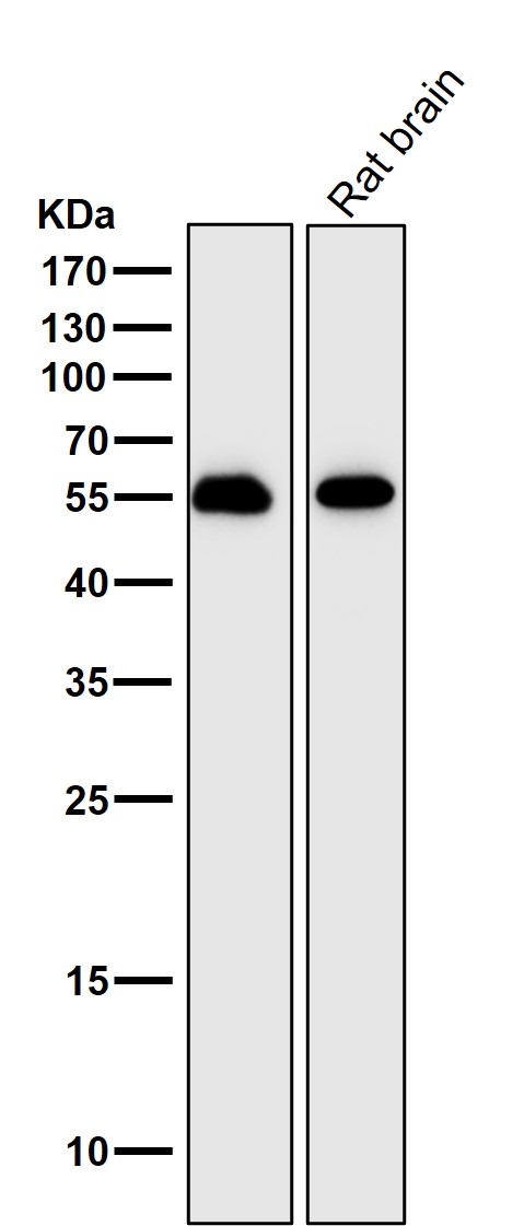 Rabbit Monoclonal to IRF7