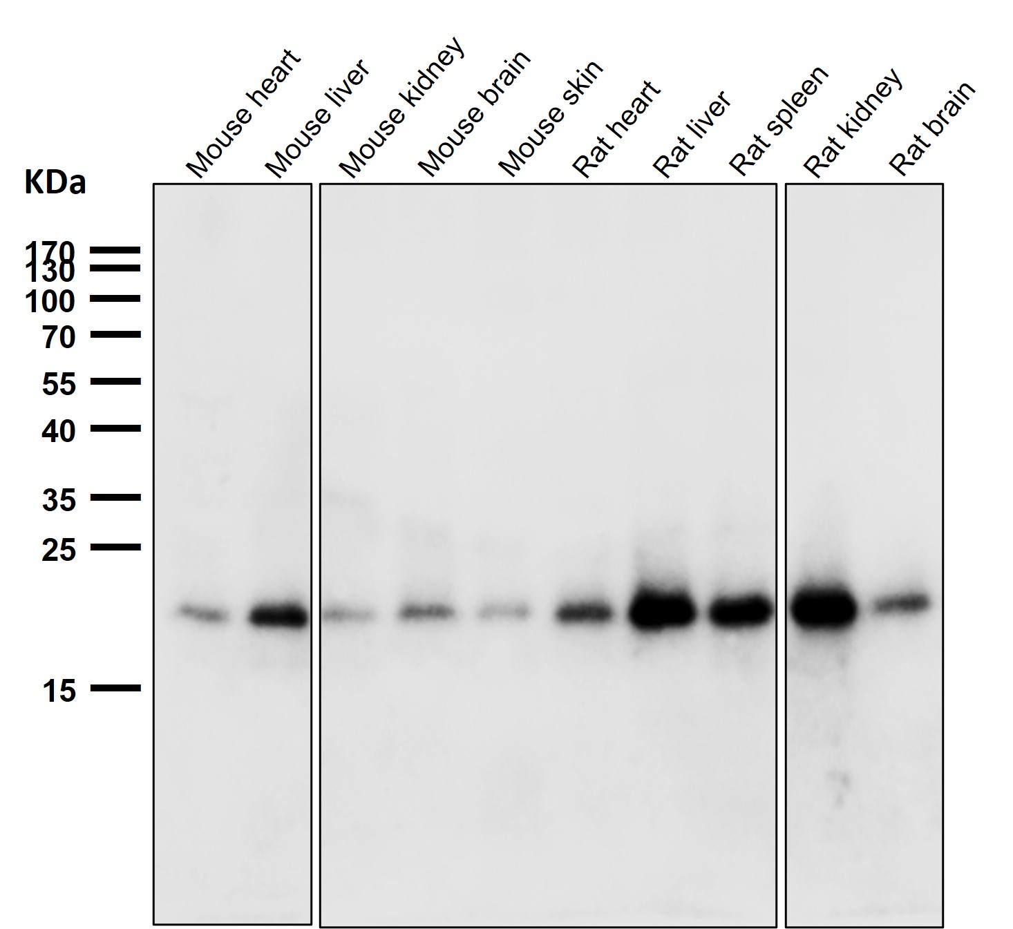 Ferritin