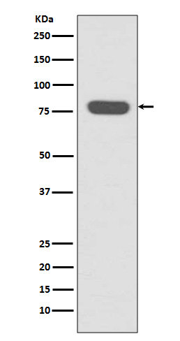 Radixin