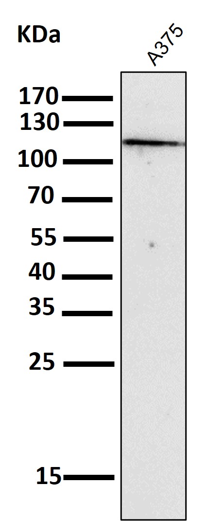NALP3