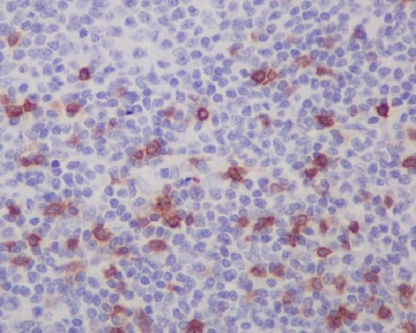 Integrin alpha E