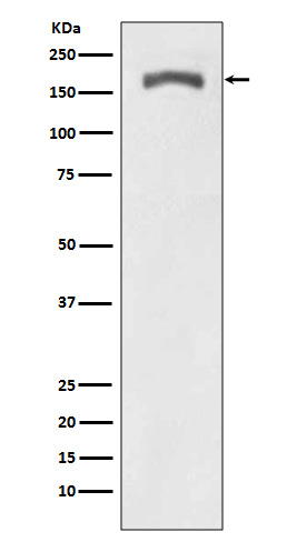 Phospho-PDGF Receptor beta(Y740)