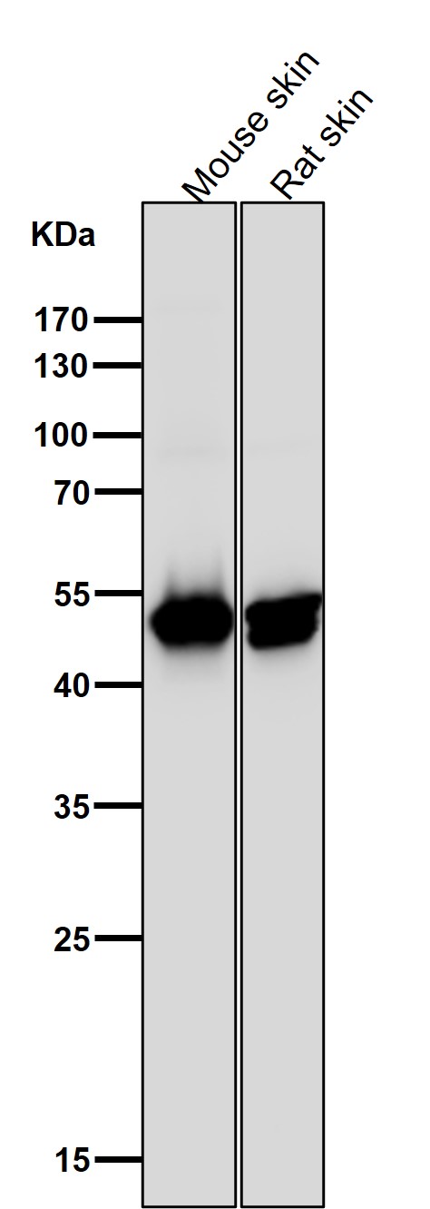 Cytokeratin14