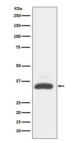 MAD2L1 binding protein