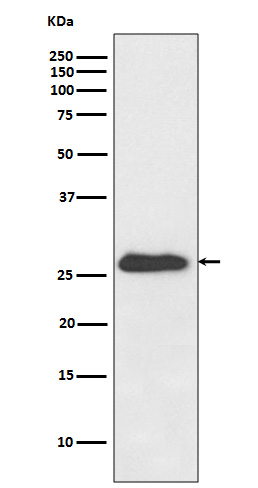 Rabbit Monoclonal to NQO2