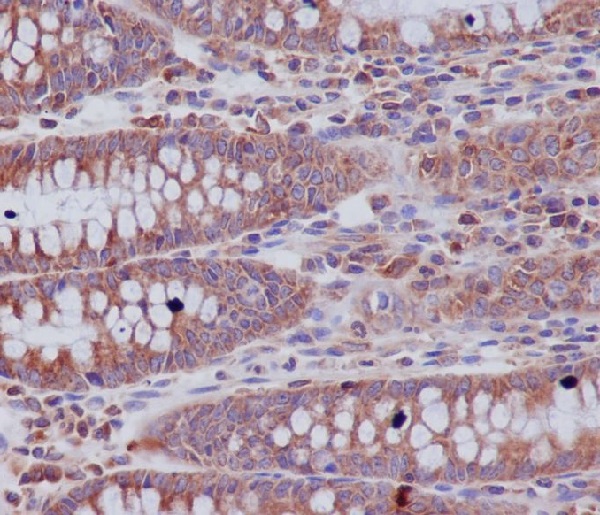 Rabbit Monoclonal to ABCF1