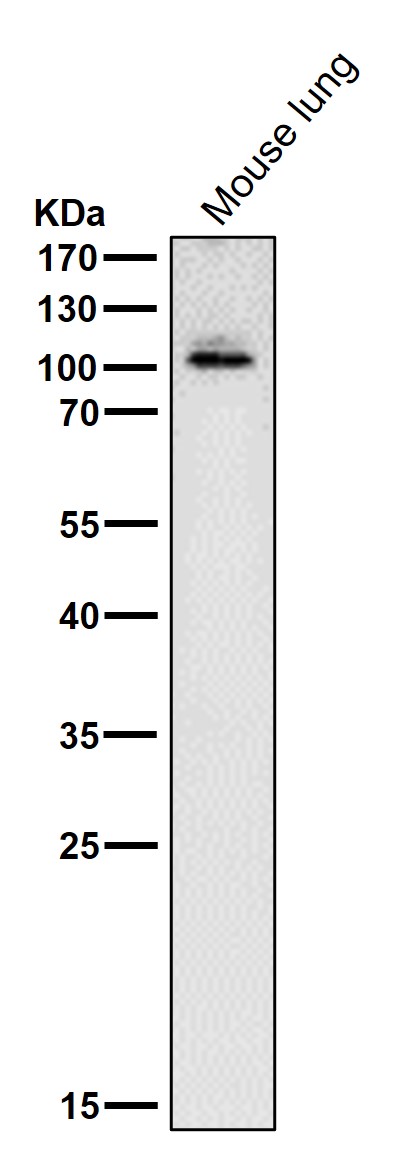 Rabbit Monoclonal to ABCF1