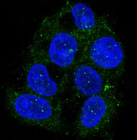 Rabbit Monoclonal to ATG9A