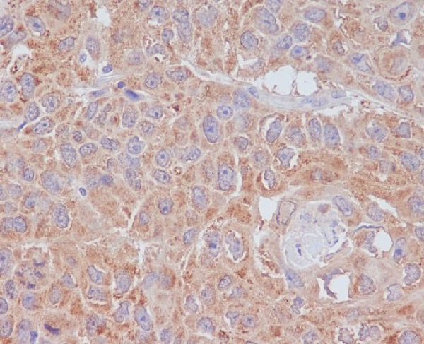 Rabbit Monoclonal to ATG9A