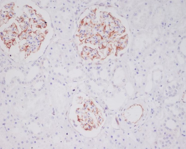 Rabbit Monoclonal to Mast Cell Tryptase