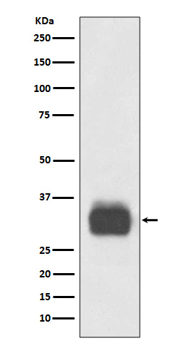 Mast Cell Tryptase